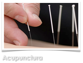 Tratamento Acupunctura